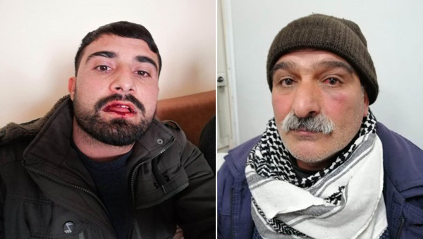 ‘Hastane dayak’ iddiası!